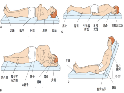 压疮易发部位